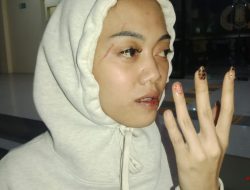 Mengaku dianiaya secara brutal Seorang wanita ini laporkan pelaku ke mapolres Situbondo
